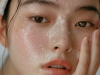 DA MỤN - SẸO RỔ