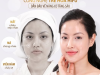 BAO LÂU NÊN ĐI LÀM HIFU MỘT LẦN | ĐỊA CHỈ SPA HIỆN ĐẠI TẠI PHÚ NHUẬN