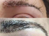 Cấy lông mày người phụ nữ nhận cái kết đáng sợ