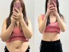 GIẢM BÉO CÔNG NGHỆ VACUUM
