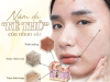 GIỚI THIỆU NHỮNG CÔNG NGHỆ TRỊ NÁM HIỆN ĐẠI TẠI SPA  