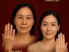 TRẺ HÓA DA TRỊ NHĂN BÀN TAY