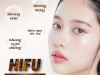 NHỮNG ĐIỀU CẦN BIẾT VỀ CÔNG NGHỆ HIFU | ƯU VÀ NHƯỢC ĐIỂM CÔNG NGHỆ HIFU