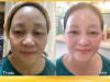 Tại TMV Thủy Venus, rất nhiều phụ nữ đang tham gia vào một liệu trình trẻ hóa da vùng mắt được truyền miệng sẽ mang lại kết quả ngay sau 5 phút