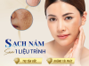 TRỊ NÁM HIỆU QUẢ SAU MỘT LIỆU TRÌNH | TRỊ NÁM TẬN GỐC TẠO HỒ CHÍ MINH |TRỊ NÁM GIÁ RẺ