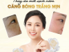 VÌ SAO NÊN TRỊ NÁM NGAY KHI CÓ THỂ | PHƯƠNG PHÁP TRỊ NÁM LÂU NĂM HIỆN NAY
