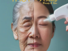 HIFU ULTHERAPY