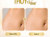 ✨ TỰ TIN DIỆN ĐẦM ÔM – TẠM BIỆT RẠN DA SAU SINH ✨