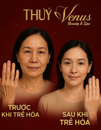 TRẺ HÓA DA TRỊ NHĂN BÀN TAY