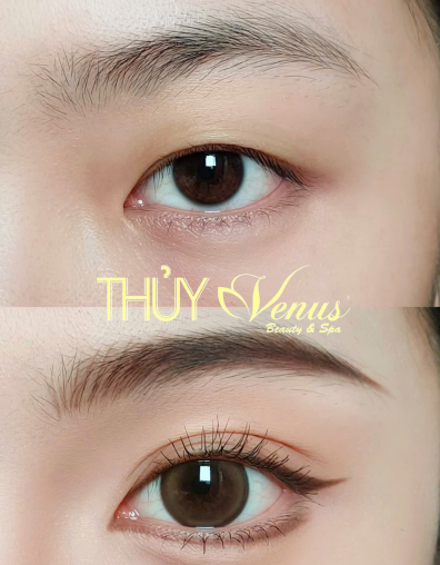PHUN MÍ MẮT MỞ TRÒNG