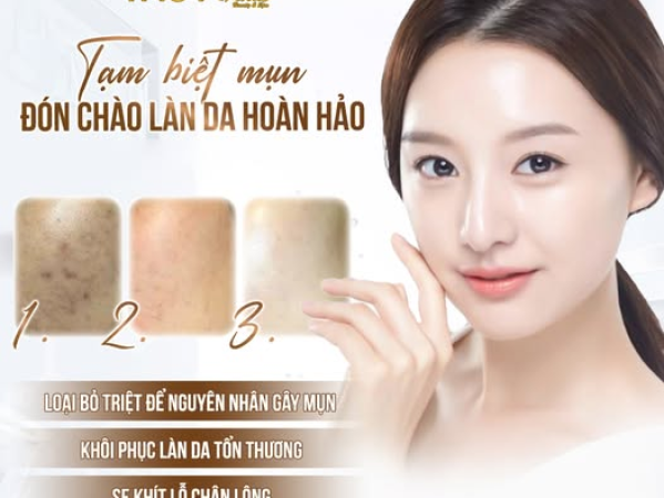 CÁCH TRỊ DA DẦU MỤN TẠI SPA | SPA TRỊ DA DẦU MỤN HIỆU QUẢ GIÁ RẺ PHÚ NHUẬN