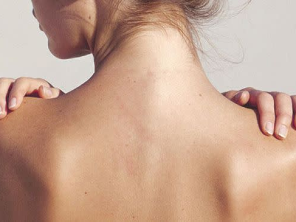 ĐIỀU TRỊ MỤN LƯNG TẠI PHÚ NHUẬN | TRỊ MỤN LƯNG HIỆU QUẢ TẠI THẨM MỸ VIỆN