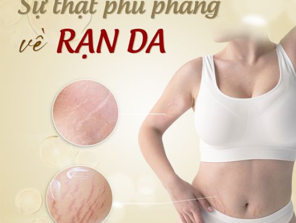 ĐIỀU TRỊ RẠN DA BẰNG CÔNG NGHỆ LASER CÓ HIỆU QUẢ KHÔNG | SPA TRỊ RẠN DA TỐT NHẤT PHÚ NHUẬN