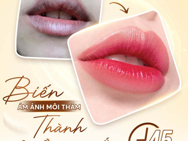 KHỬ THÂM PHUN MÔI CÓ ĐAU KHÔNG | ĐỊA CHỈ KHỬ THÂM PHUN MÔI THẨM MỸ TẠI PHÚ NHUẬN