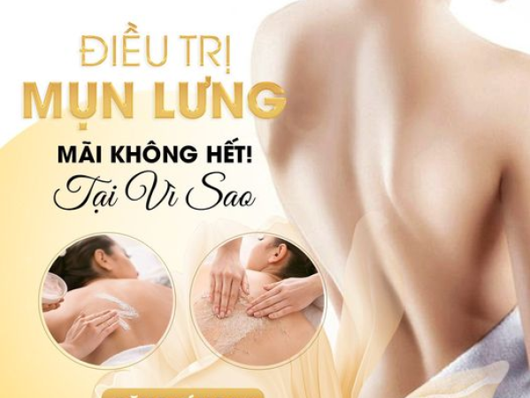 NGUYÊN NHÂN GÂY NÊN MỤN Ở LƯNG VÀ CÁCH ĐIỀU TRỊ | ĐỊA CHỈ TRỊ MỤN LƯNG GIÁ RẺ PHÚ NHUẬN