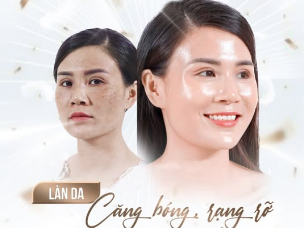 NHỮNG LƯU Ý KH TIÊM MESO | TIÊM MESO CĂNG BÓNG DA TẠI SPA PHÚ NHUẬN