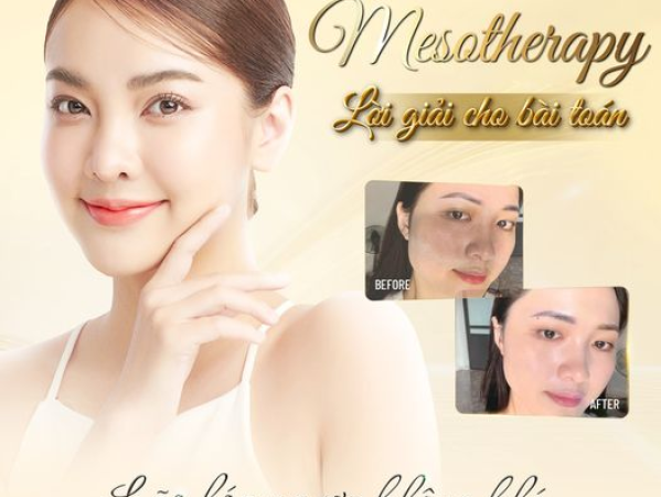 NHỮNG PHƯƠNG PHÁP CĂNG BÓNG DA HIỆN ĐẠI HIỆN NAY | ĐỊA CHỈ CĂNG BÓNG DA CHUYÊN SÂU TẠI SPA