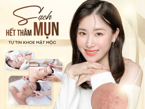 Những Phương Pháp Giảm Mụn Tại Nhà Hiệu Quả Và Lợi Ích Khi Điều Trị Mụn Tại Spa | Trị Mụn An Toàn Tại Spa