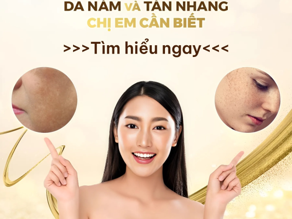 PHÂN BIỆT NÁM DA, TÀN NHANG VÀ ĐỒI MỒI | TRỊ NÁM HIỆU QUẢ TẠI SPA HỒ CHÍ MINH