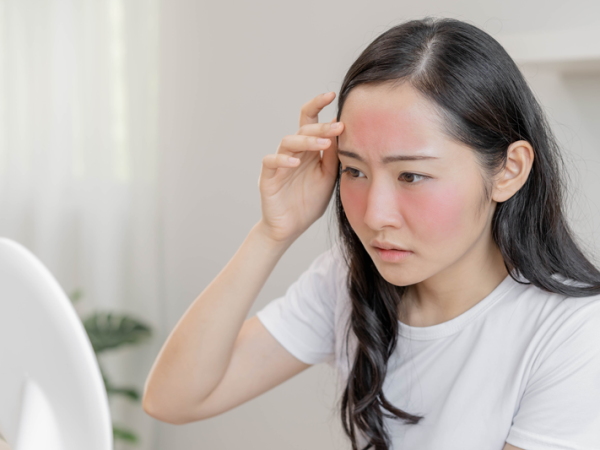 PHỤC HỒI DA SAU TẾT | CHĂM SÓC DA TẠI HỒ CHÍ MINH | CHĂM SÓC DA TẠI SPA GIÁ RẺ