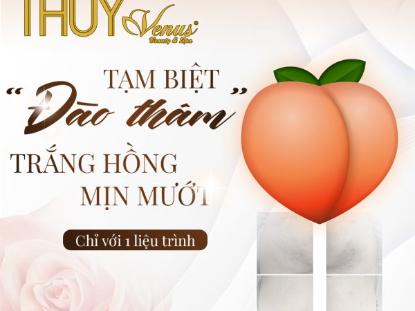 PHƯƠNG PHÁP TRỊ THÂM MÔNG HIỆU QUẢ | TRỊ THÂM MÔNG BẰNG LASER | TRỊ THÂM MÔNG SỐ 1 HỒ CHÍ MINH