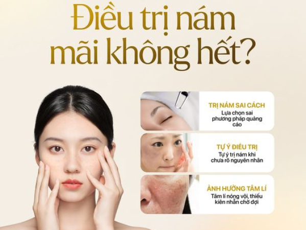 TẠI SAO ĐIỀU TRỊ NÁM MÃI KHÔNG HẾT | CÁC CHĂM DA SAU KHI TRỊ NÁM