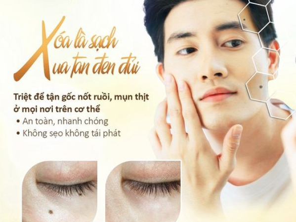 TẨY NỐT RUỒI TẠI SPA  SAU MỘT LIỆU TRÌNH | ĐỊA CHỈ TẨY NỐT RUỒI GIÁ RẺ TẠI PHÚ NHUẬN