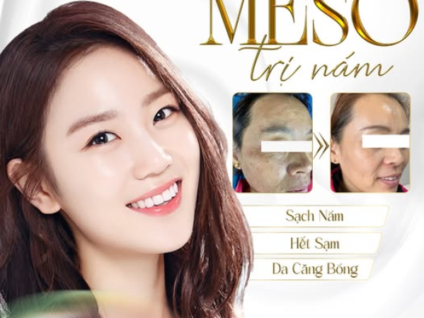 TIÊM MESO CÓ TÁC DỤNG PHỤ KHÔNG? | ĐỊA CHỈ TIÊM MESO AN TOÀN TẠI HỒ CHÍ MINH