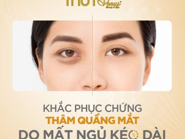 TRỊ THÂM QUẦNG MẮT CÓ HẾT KHÔNG? | SPA TRỊ THÂM QUẦNG MẮT NHANH CHÓNG HIỆU QUẢ TẠI HỒ CHÍ MINH
