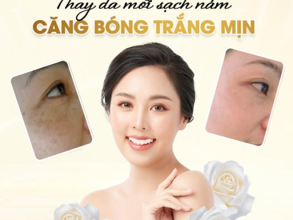 VÌ SAO NÊN TRỊ NÁM NGAY KHI CÓ THỂ | PHƯƠNG PHÁP TRỊ NÁM LÂU NĂM HIỆN NAY