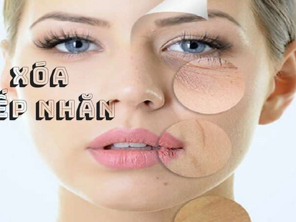 Xóa nhăn mắt hiệu quả | Phương pháp xóa nhăn mắt | Viện thẩm mỹ công nghệ cao Thủy Venus